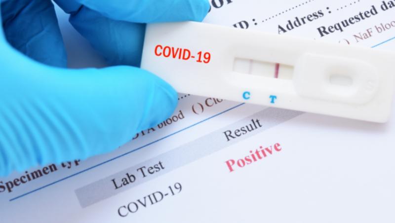 Рассматриваем виды тестов на COVID-19: эффективность и качество